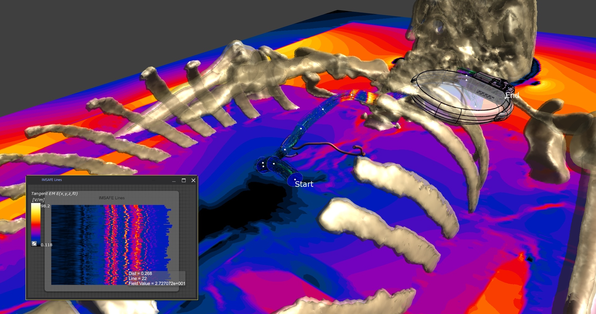 Image showing simulation safety assessment of an implanted pacemaker with IMSafe readout 