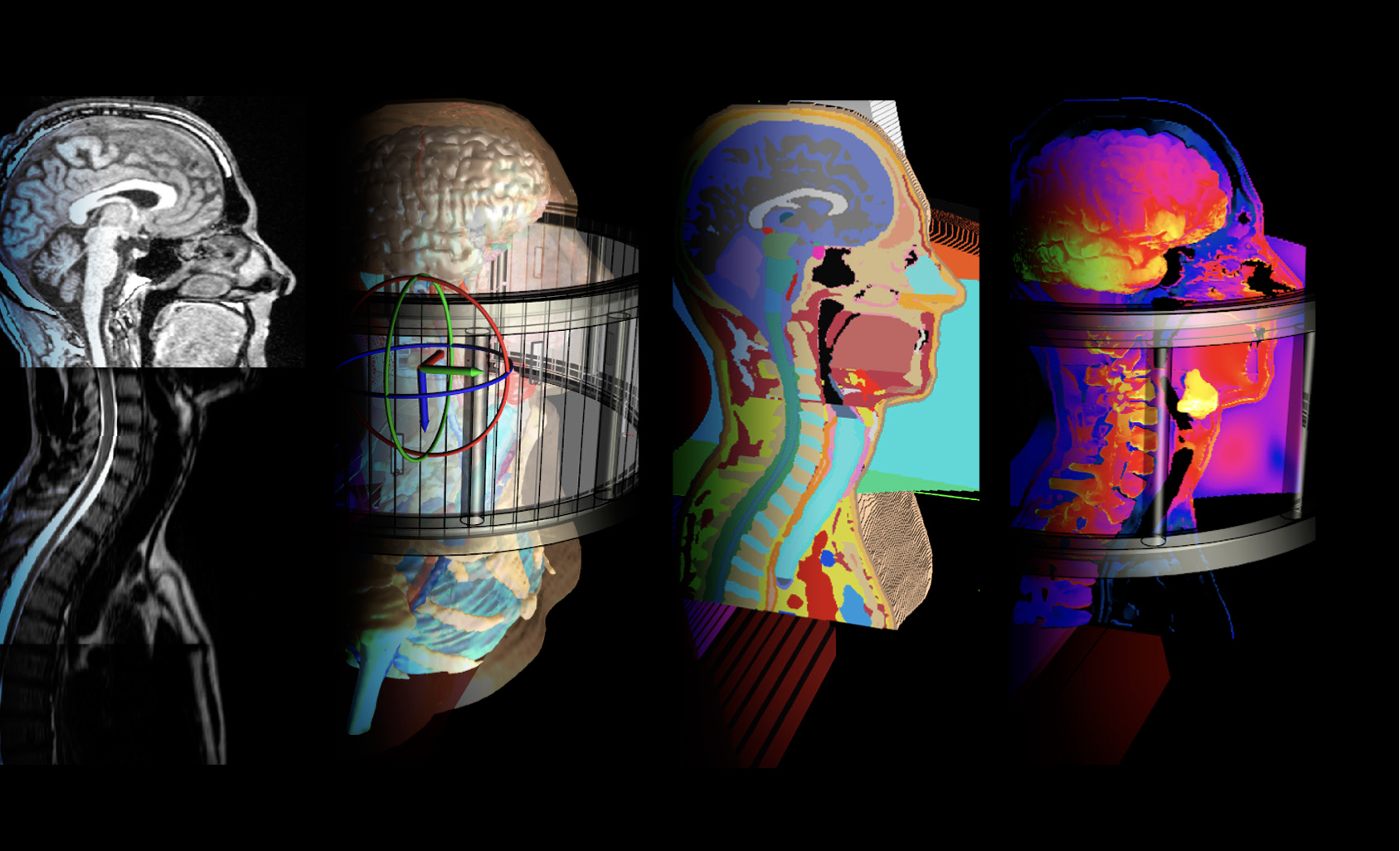 4 visualizations of a head model from MRI data input through segmentation to electromagnetic simulation 4 visualizations of a head model from MRI data input through segmentation to electromagnetic simulation