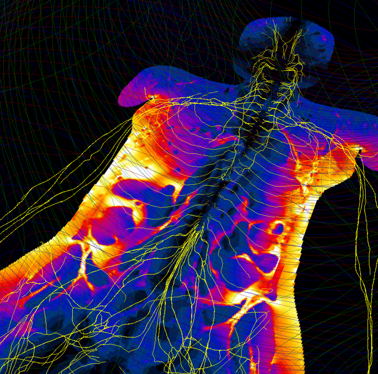 Image showing the Sim4Life electromagnetics full wave solver (P-EM-FDTD) applied to a simulated ViP human torso