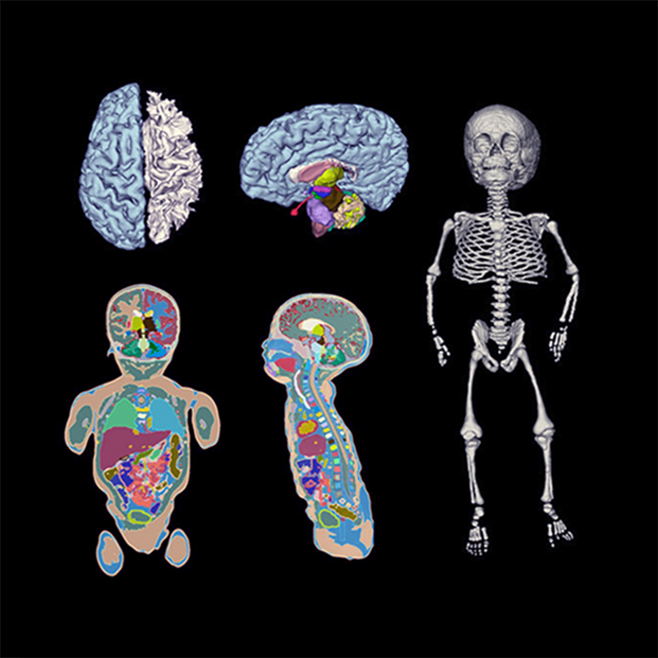 IT’IS Hosts New Pediatric Model THALIA V1.0