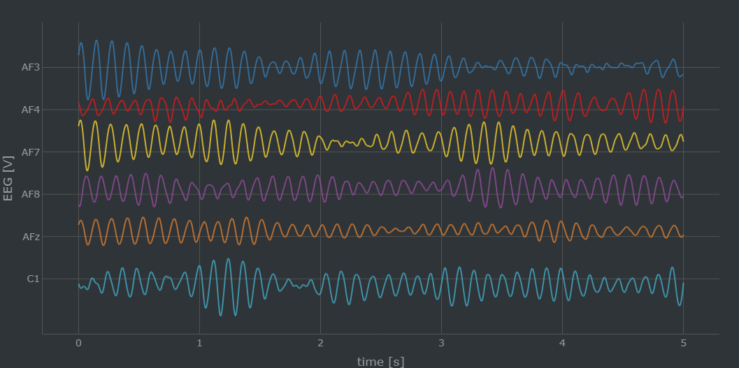 Simulated scalp EEG from the unstimulated network