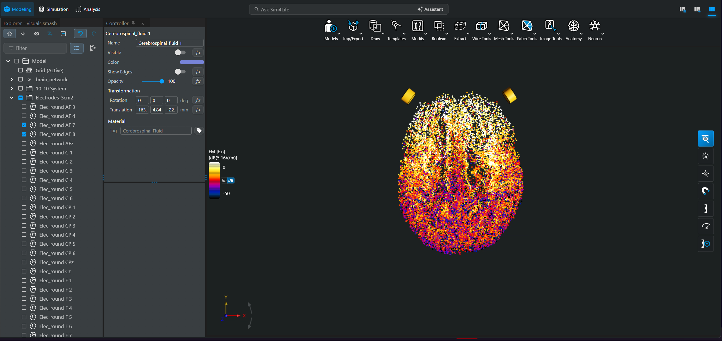Stimulation field component aligned with cortical columns