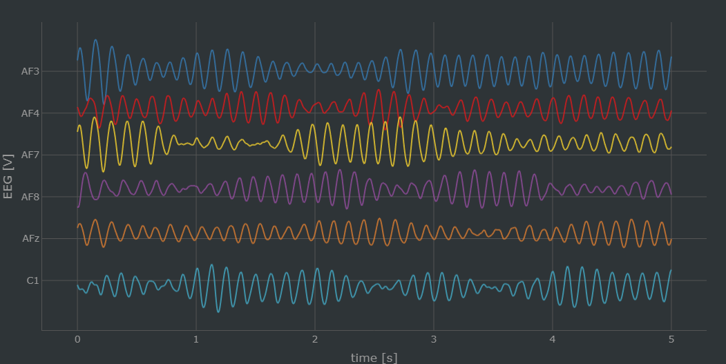 Simulated EEG with and without stimulation