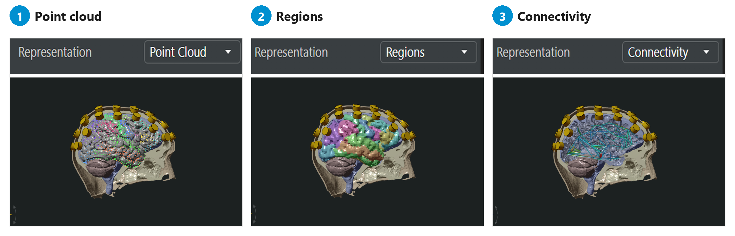 Whole-brain network model loaded in Sim4Life V10.0
