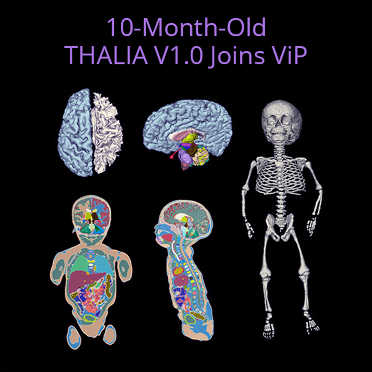 IT’IS Hosts New Pediatric Model THALIA V1.0
